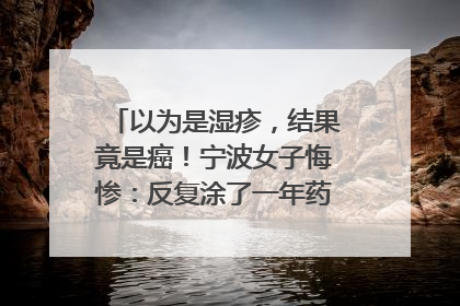 以为是湿疹，结果竟是癌！宁波女子悔惨：反复涂了一年药膏都没好！很多患者首诊都去了皮肤科